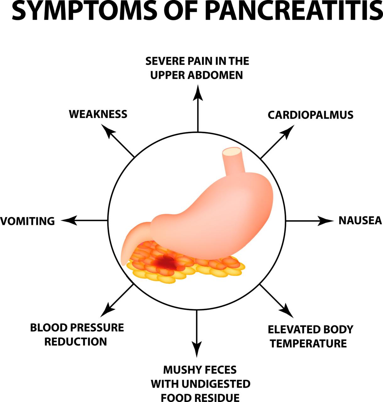 Image showing symptoms of pancreatitis related to alcohol use.